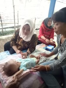 Penderita Hidrosefalus, Suci Nabila, Butuh Bantuan Pemerintah.