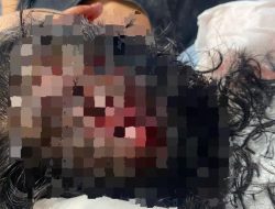 Diduga Seorang Remaja Jadi Korban Penganiayaan Tetangganya Sendiri, Korban Mengalami Luka Dikepalanya